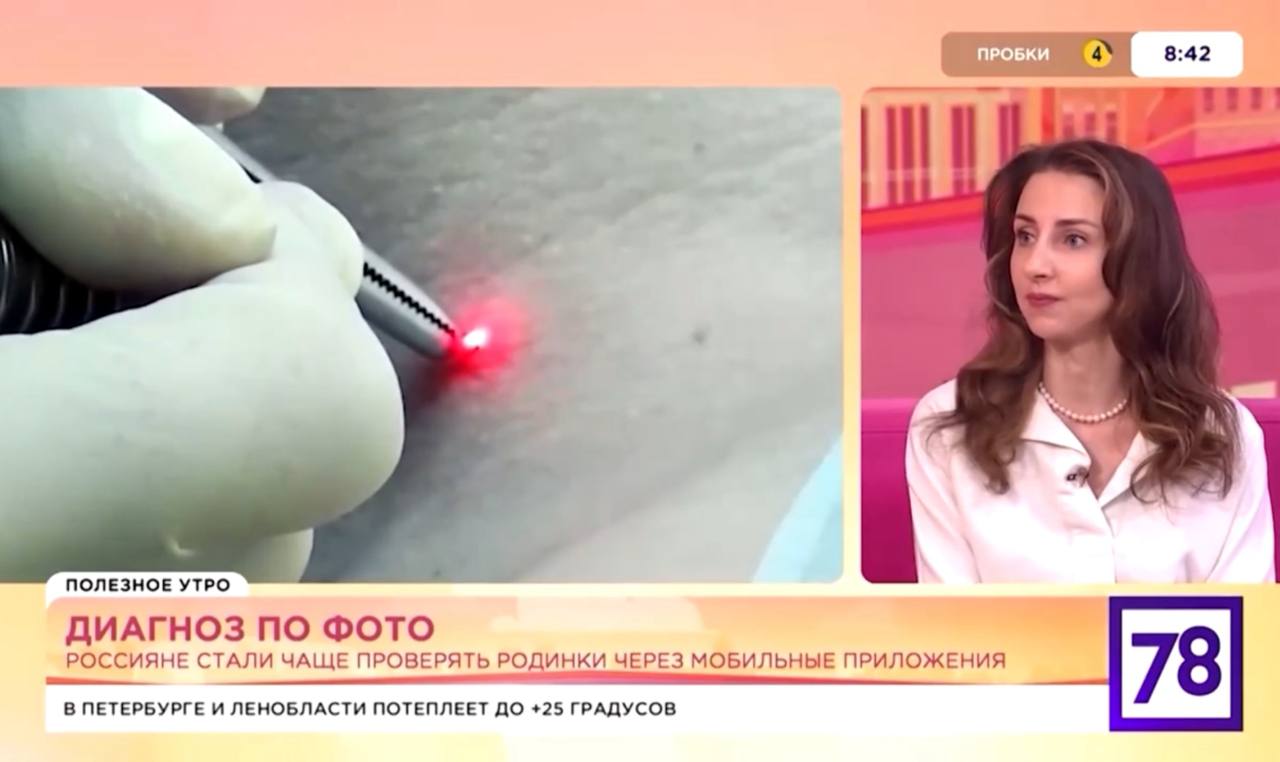 Утреннее шоу на 78 канале на тему «Родинки»